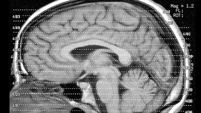 artificial-brain_m