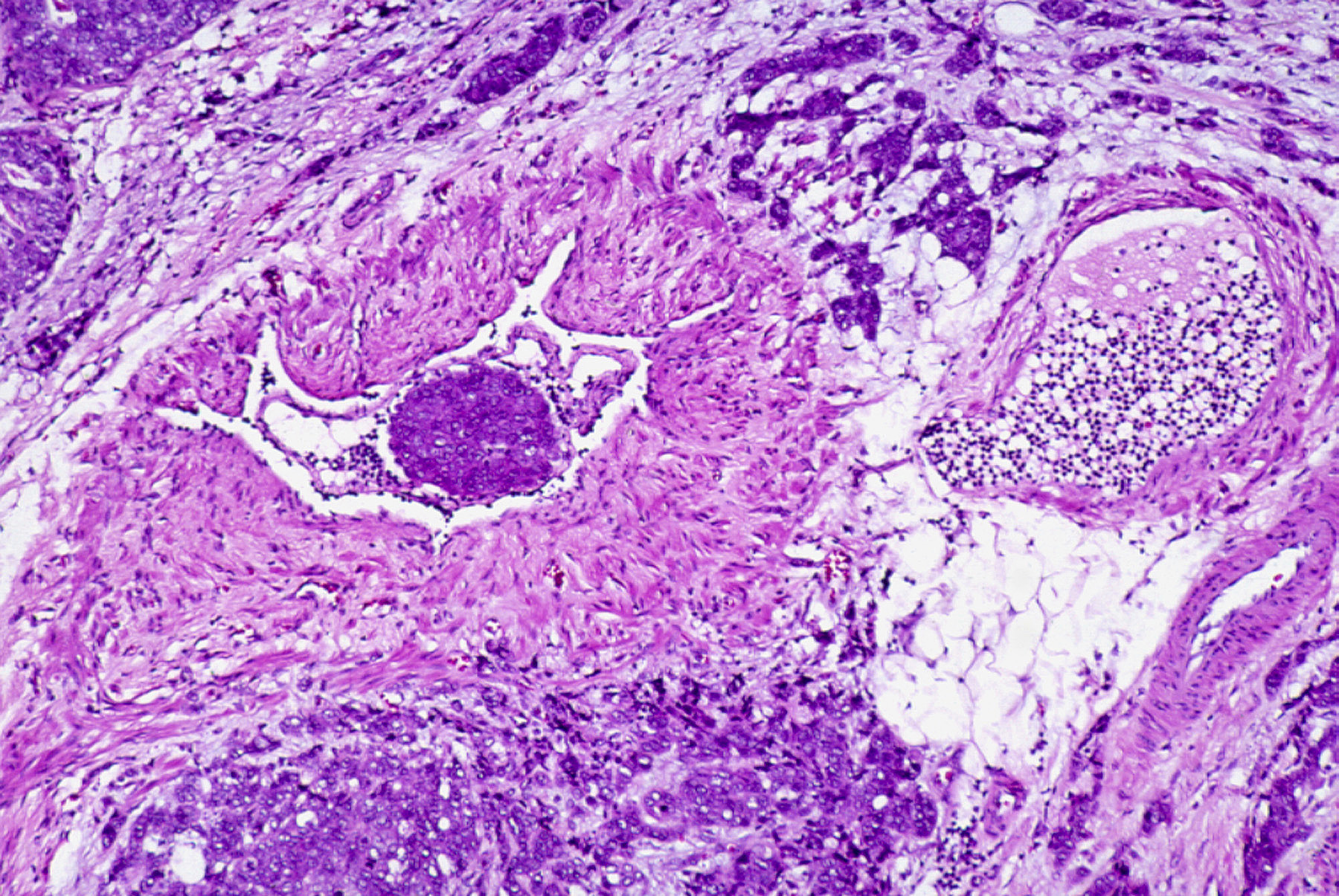 deep-learning-breast-cancer-diagnosis_m