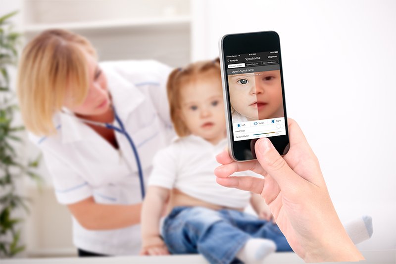 ai-diagnose-rare-genetic-diseases_m