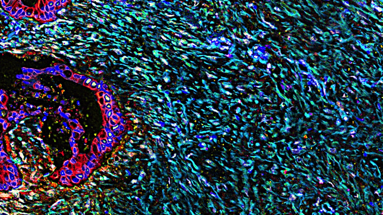 dream-challenge-proteogenomics_m
