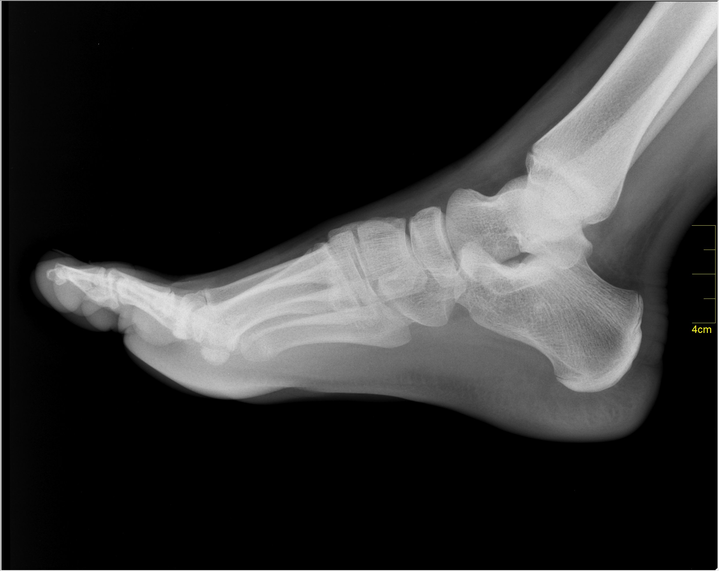 how-one-professor-is-advancing-lower-limb-treatments_m