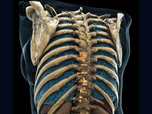 improving-cancer-diagnosis_m