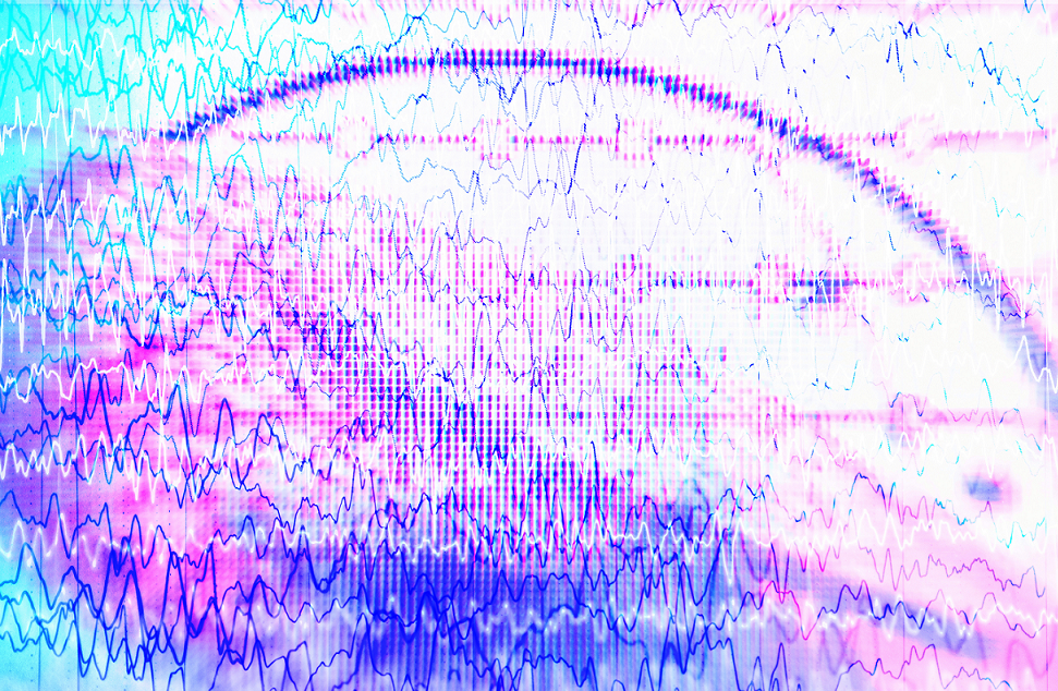 eeg-epilepsy_m