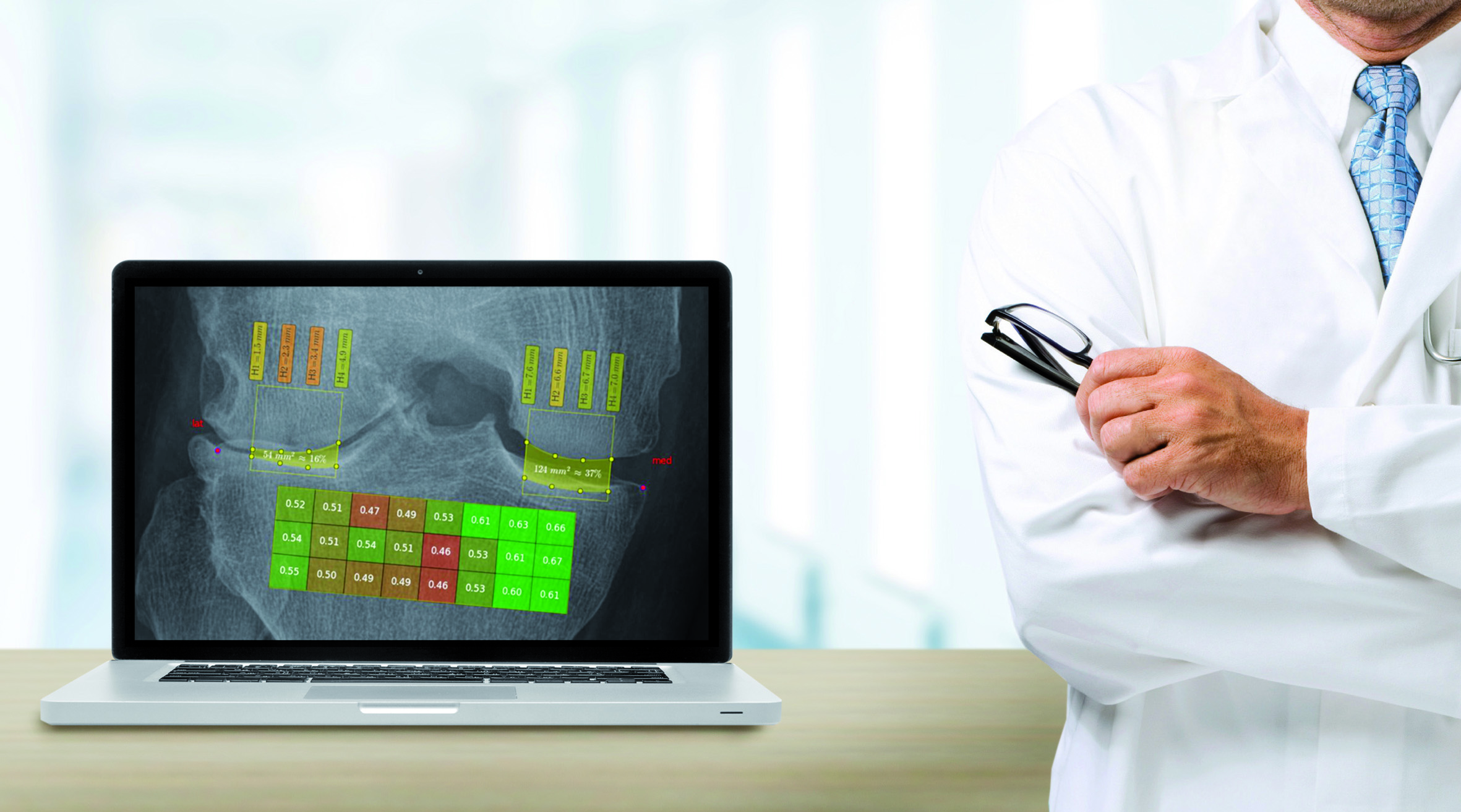 ai-osteoarthritis_m