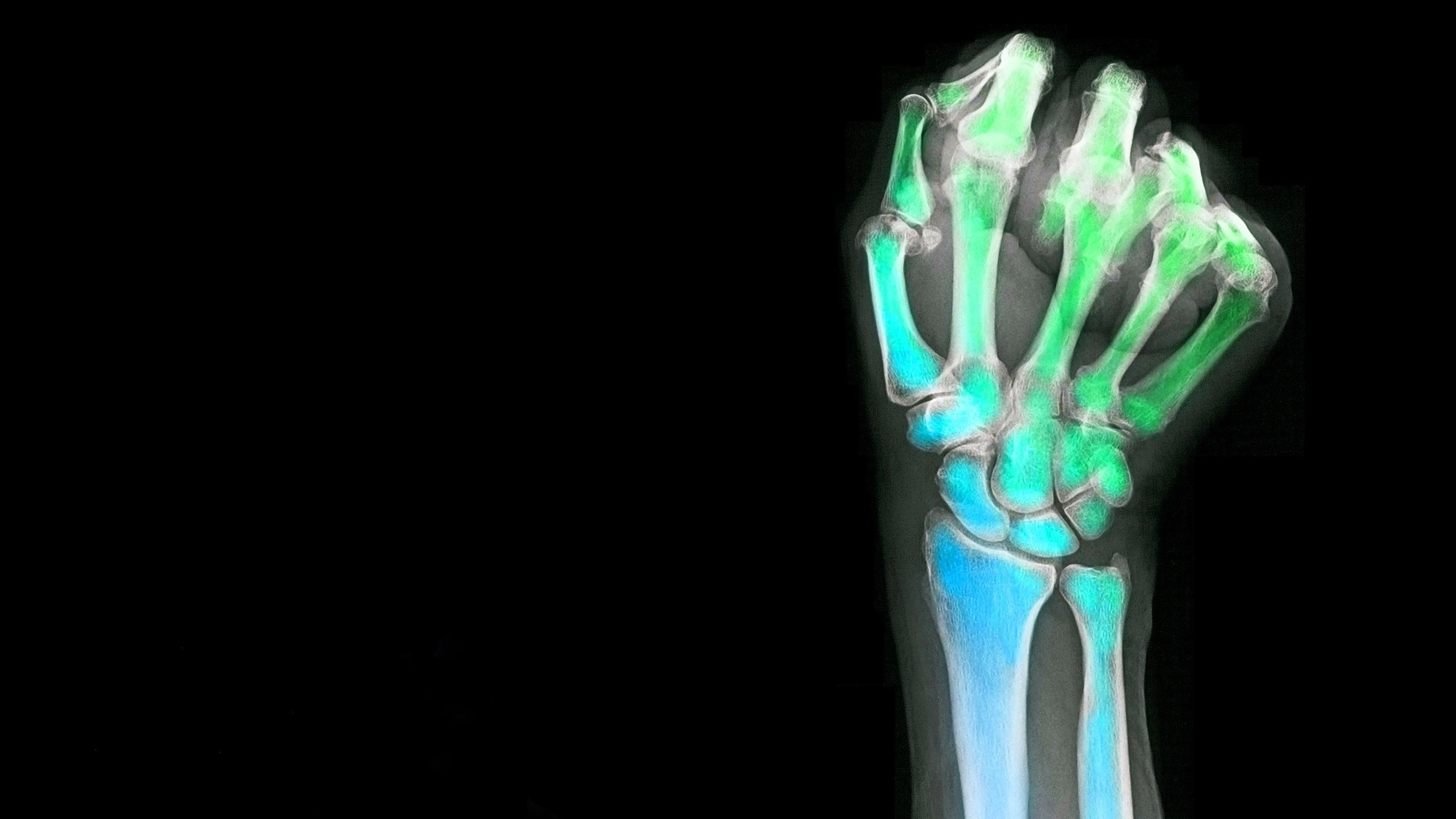 ai-startup-reinvent-radiology_m