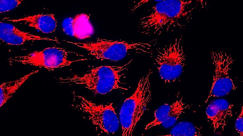 cell-nuclei-wikimedia-commons_16-9_m