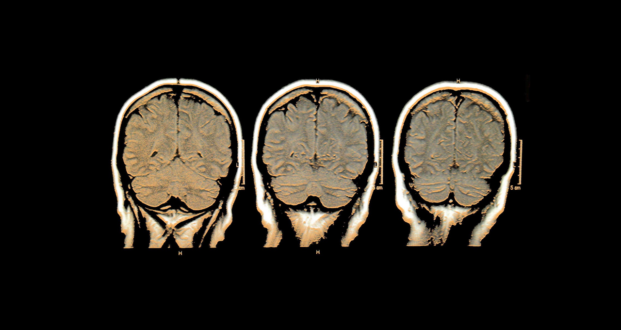 10-brain-scan-1280x680_m