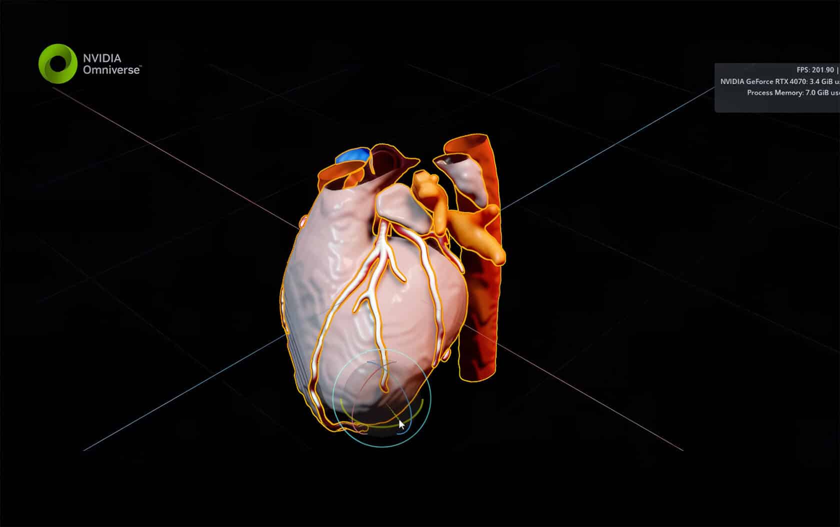 Nvidia Pacemaker 鴻海科技集團利用 NVIDIA 技術加速全球醫療照護產業的物理與數位機器人 - NVIDIA 台灣官方部落格 鴻海科技集團利用 NVIDIA ...